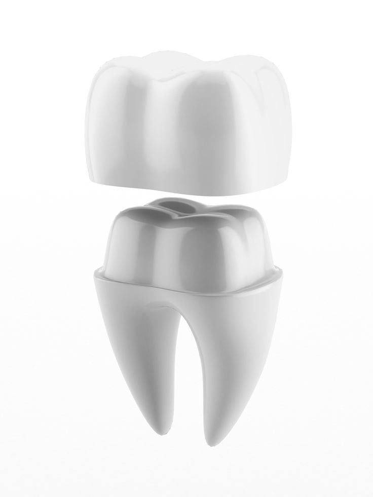 Types of Dental Crowns